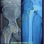 Orthocare Hospital